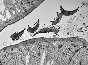 Giardia (Lamblia) intestinalis